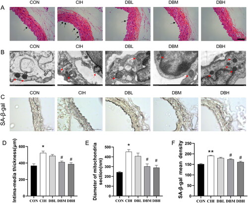 Figure 3. DBD mitigated vascular injury on morphology of aortas in CIH mice. (A) H&E staining of the aortas. The arrows indicate shedding of the endothelial cells and proliferating in media in CIH aortas (scale bar = 50 μm). (B) Transmission electron microscope images of mitochondria in the aortas. The arrows indicate mitochondria in the endothelial cells (× 12000). (C) SA-β-gal staining of aortas (scale bar = 50 μm). (D) The intima-media thickness of thoracic aortas. (E) The diameter of mitochondria section. (F) The mean density of SA-β-gal. Data are expressed as the mean ± SEM, n = 3. (*p < 0.05 vs. CON group, **p < 0.01 vs. CON group; #p < 0.05 vs. CIH group).