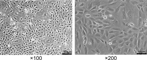 Figure 1 Morphology of normal HUVECs.