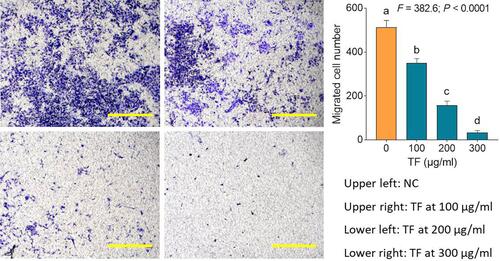 Figure 3 Transwell assay of B16F10 cells with TF treatments. Data (mean ± SD) points with different letters (a, b, c, and d) indicate significant difference between each other [Fisher’s least significant difference (LSD), P < 0.05], and the values decrease with the order from a to d. Scale bar = 500 μm.