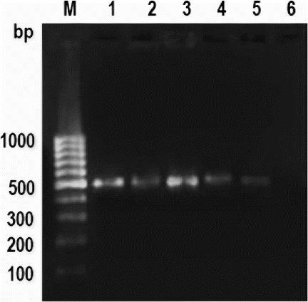 Figure 3.  PCR amplification pattern of mitochondrial 16S rRNA gene in autoclaved meat emulsion. Note: Lane M: 100 bp Ladder, Lane 1: cattle, Lane 2: buffalo, Lane 3: sheep, Lane 4: goat, Lane 5: pig and Lane 6: negative control.