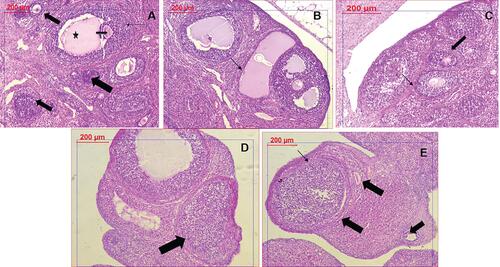 Figure 8 Histopathological examination of ovarian tissues in different groups. (A) Control group showing healthy follicles with oocytes (arrows) and antrum (star). (B) PCOS tissue showing numerous large cysts, and absence of oocytes. (C) Clomiphene treatment showing thicker granulosa cells and oocytes (D) NC-100 treated group showing normal granulosa cells and follicle (E) NC-200 group showing granulosa cells, normal follicles, and oocytes.