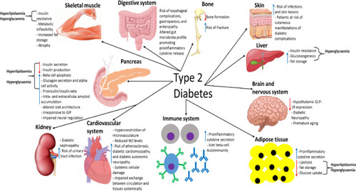 Figure 7 A summary of the pathological effects that T2D has on different organs and systems throughout the body, some of which directly contribute to the disease-associated dyslipidaemia/hyperglycaemia and subsequent clinical symptoms. This figure and information in its legend are with data adapted from these studies.Citation94,Citation105,Citation106,Citation111,Citation192–Citation195,Citation206,Citation214,Citation219–Citation222,Citation225,Citation228,Citation232,Citation241,Citation326–Citation328,Citation331