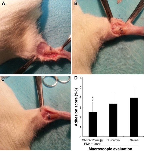 Figure 3 Representative gross anatomy after treatments and laser exposure.Notes: (A) GNRs-1/curc@PMs + laser group. (B) Curcumin group. (C) Saline group. (D) Macroscopic peritendinous adhesion scoring: *P<0.01 vs curcumin group and #P<0.01 vs saline group. Student’s t-tests assuming unequal variance were performed. The results were expressed as mean values ± standard deviation.