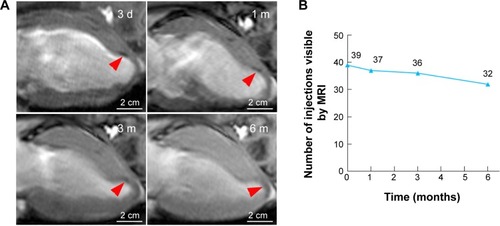 Figure 6 Long-term CMR tracking.Notes: (A) Representative serial long-axis views imaged at 3 d, 1 m, 3 m, and 6 m after infarction show the signal void (red arrows) gradually faded over time. (B) The number of visible injection sites by CMR gradually decreased over time post-injection.Abbreviations: CMR, cardiac magnetic resonance; d, days; m, months.