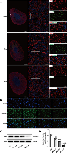 Figure 2 Effect of high glucose on Claudin-2 in PTECs by IF staining and Western blot in vivo and in vitro. (A) Diabetes decreased the expression of Claudin-2 in PTs. Five months after STZ injection, the expression (assessed by confocal microscopy) of Claudin-2 was studied. Diabetes significantly decreased Claudin-2 (green) expression in the apical membrane of PTECs, as shown by immunofluorescence. DppD (red) was used as a marker of PTs. Magnification: × 5, scale bar =2000µm. Magnification: ×100, scale bar =100µm. Magnification: ×200, scale bar =50µm. (B) NRK52E cells were cultured in 30mM D-glucose (HG) medium for 24 hours, 48 hours, and 72 hours, respectively. The effect of HG in the protein expression of Claudin-2 was stained and observed under a fluorescence microscope at a magnification of ×400, scale bar =100µm. (C and D) Western blot and quantitative analysis showed that the expression of Claudin-2 protein increased in a time-dependent manner when PTECs were exposed to HG. Values represent mean ± SEM, n = 3, **P < 0.01, vs NG; #P < 0.05, ##P < 0.01 vs HG (24h); &P<0.05 vs HG (48h).