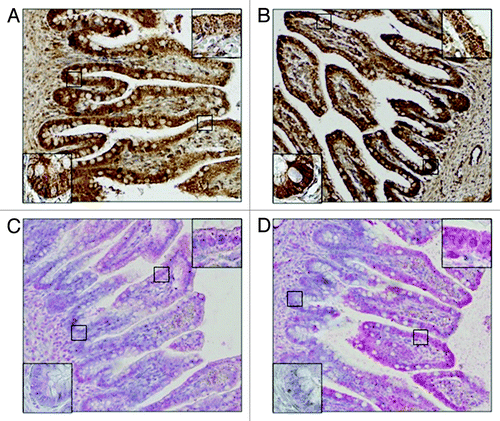 Figure 2. Differences between signal localization in fetal intestine in 16th week of IUD. CYP2C8 (A) and CYP2C9 (B) in enterocytes show stronger positivity in crypts than in apex of villi. On the other hand, CYP2C19 (C) and CYP2J2 (D) show stronger positivity in apex of villi, area of crypts is almost negative.