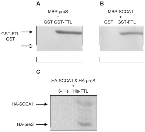 Figure 1 (A) Western blot of preS-pulldowned proteins; (B) Western blot of SCCA1-pulldowned proteins; (C) Western blot of FTL-pulldowned proteins. For A, MBP-preS was pre-incubated with either GST-FTL or GST before mixing with amylose beads; for B, MBP-SCCA1 was pre-incubated with either GST-FTL or GST before mixing with amylose beads; for C, HA-tagged preS and SCCA1 were coexpressed with His-tagged FTL protein in HepG2 cells before immunoprecipitation by anti-His-tag antibody.Abbreviations: MBP, maltose binding protein; GST, glutathione-S-transferase; FTL, ferritin light chain; SCCA1, squamous cell carcinoma antigen 1.