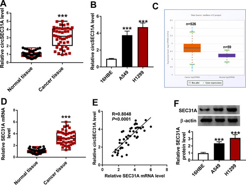 Figure 1 CircSEC31A and SEC31A were significantly upregulated in NSCLC tissues and cells. The expression of circSEC31A by qRT-PCR in 44 pairs of tumor tissues and matched non-tumor tissues (A), 16HBE, A549 and H1299 cells (B). (C) The expression pattern of SEC31A in 526 lung adenocarcinoma specimens and 59 normal controls showed by the starbase v.3 software. (D) SEC31A level by qRT-PCR in 44 pairs of tumor tissues and matched non-tumor tissues. (E) Correlation of SEC31A level and circSEC31A expression in 44 NSCLC tissues using the Specimen test. (F) SEC31A level by qRT-PCR in 16HBE, A549 and H1299 cells. ***P < 0.001.