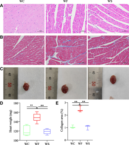 Figure 3 Effect of semaglutide on histopathological changes in high-fat diet-induced obese hearts stained with HE and Masson. (A) HE staining of cardiac tissue. (B) Masson staining of cardiac tissue. (C) Representative images of mouse heart tissue. (D) Comparison of heart weights between the three groups (n=8). (E) Comparison of cardiac collagen area between the three groups (n=3). Values for each group are shown as mean±standard deviation. Data were compared between the three groups using a one-way ANOVA test. **P < 0.01, andP > 0.05.