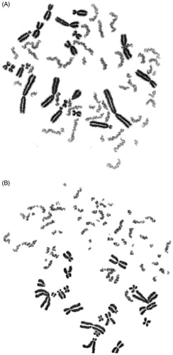 Figure 1. Giemsa-stained PCC showing 46 single chromatid chromosomes in non-irradiated G0-peripheral blood lymphocyte (A). Sixteen fragments in excess of 46 PCC can be visualized in an irradiated lymphocyte with 4 Gy when analyzed shortly after exposure (B).