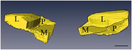 Figure 7. Schematic drawings of the UF layer divided into three regions. The lateral part of UF layer appeared superficially compared to the medial part. The transition of tissues from ligament to UF in the insertion first occured in the lateral part, and there was almost no intersection of the lateral and medial UF parts. The architecture varied with the lateral and medial regions appearing as separate plateaus. Compared with the lateral and medial parts, the posterior UF part demonstrated different spatial structures and presented a hollow slope shape (P, posterior; M, medial; L, lateral). Scale bar = 2 mm.