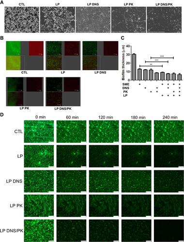 Figure 3 The antibacterial activity of SME (150 μg/mL) and/or DNS/PK (25 and 10 μg/mL) in free or liposomal form against Cutibacterium acnes biofilm determined by imaging after a 24-h treatment: (A) the biofilm structure observed by scanning electron microscopy; (B) the biofilm structure observed by confocal microscopy; (C) the biofilm thickness quantified from confocal microscopy; and (D) the biofilm mass attached on the surface of microfluidic chamber observed by confocal microscopy. All data are presented as the mean of three experiments±S.E.M. ***p < 0.001; **p < 0.01.