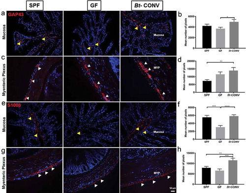 Figure 3. Bt-CONV increases neuronal budding and glial cells.