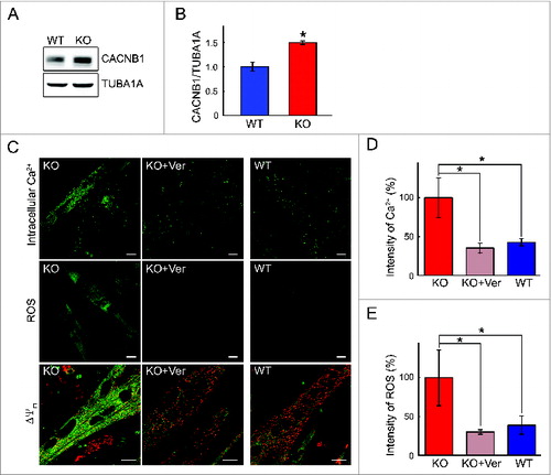 Figure 11. Reversibility of the phenotype by a Ca2+ channel blocker. (A and B) Western blot of total lysates from WT and KO myotubes shows a dramatic increase in the levels of the CACNB1. (C, D, and E) KO myotubes (d 4 in differentiation medium) were incubated with verapamil (Ver; 10 μM) for 24 h. The abnormal phenotype (left panels) in KO myotubes—increased intracellular Ca2+ and ROS production, and a loss of ΔΨm—was reversed to the normal phenotype (right panels) following treatment with the drug (middle panels). Bar = 10 μm. Asterisks indicate P < 0.05.