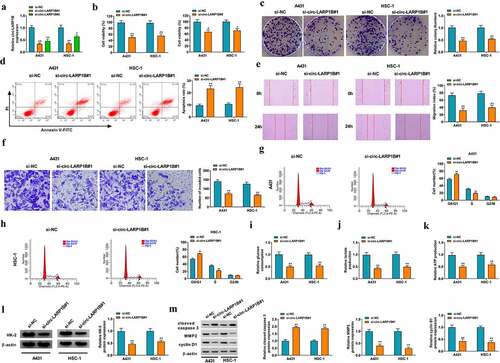 Figure 2. Circ-LARP1B silencing suppresses the malignant phenotypes of CSCC cells. (a) RT-qPCR was conducted to analyze the knockdown efficiencies of two siRNAs of circ-LARP1B (si-circ-LARP1B#1 and si-circ-LARP1B#2). (b-m) CSCC cells were transfected with si-NC or si-circ-LARP1B#1. (b) Cell viability was analyzed by MTT assay. (c) The colony formation ability of CSCC cells was analyzed by colony formation assay. (d) Cell apoptosis was measured by flow cytometry. (e) Cell migration ability was assessed by wound healing assay. (f) Cell invasion capacity was detected by transwell invasion assay. (g and h) Cell cycle progression was analyzed by flow cytometry. (i-k) Cell glycolytic metabolism was analyzed using Glucose Uptake Colorimetric Assay kit, Lactate Assay Kit II, and ATP colorimetric Assay kit. (l) Western blot assay was conducted to determine the protein expression of HK-2 in CSCC cells. (m) The levels of apoptosis-, metastasis-, and proliferation-associated proteins (cleaved caspase 3, MMP2, and cyclin D1) were detected by Western blot assay. *P < 0.05, **P < 0.01.