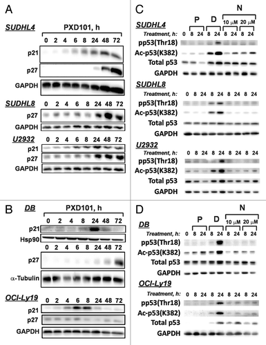 Figure 7. PXD101 effects on expression of cyclin-dependent kinase inhibitors (CKI) p21 and p27 and modification of p53. (A and B) The cell lines shown were treated with PXD101 for 0, 2, 4, 8, 24, 48, and 72 h. Whole cell extracts were generated and subjected to western blotting with antibodies against p21, p27, hsp90, α-tubulin, or GAPDH. PXD101-resistant cell lines are shown in (A) while PXD101-sensitive cell lines are shown in (B). (C and D) Cells were treated with PXD101 (P), doxorubicin (2 μM) (D), or Nutlin-3A (10 or 20 μM) (N) for 8 or 24 h. Whole cell extracts from treated and untreated cells were generated and subjected to western blotting with the antibodies indicated. PXD101-resistant cell lines are shown in (C) while PXD101-sensitive cell lines are shown in (D). The blots shown are representative of 3 independent experiments.