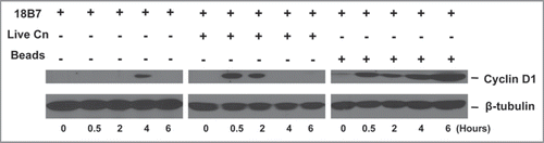 Figure 1 Western blots of Cyclin D1 in bone marrow macrophage cell extract after Fc-mediated phagocytosis of live Cn or polystyrene beads. Bone marrow macrophage cells were challenged with mAb 18B7-opsonized live Cn or polystyrene beads at an E:T ratio of 1:1. In the negative control group, mAb 18B7 without the presence of particles was added. Macrophage cell contents were extracted after 0, 0.5, 2, 4 and 6 h post challenge. Cyclin D1 expression levels in the cell extracts after phagocytosis assay were probed by western blots. The same loading amount for each sample was confirmed by β-tubulin western blots. The experiment has been independently repeated three times and produced similar results.