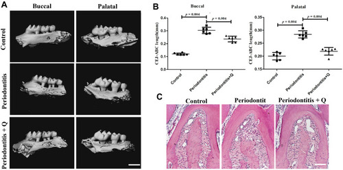 Figure 6 Quercetin prevents against alveolar bone resorption in mice with periodontitis. (A) Micro-CT reconstruction images, including the buccal and palatal sides of the maxillaries, in the control, periodontitis, and periodontitis + quercetin groups (n=6 each group). Scale bar: 1 mm. (B) The distance from the CEJ to the ABC of the maxillary second molars was analyzed based on the micro-CT results. (C) Representative H&E staining images of each group. Scale bar: 50 μm. All data are presented as the mean ± SD and specific p values are indicated on the graphs.