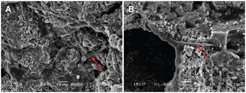 Figure 10 Scanning electron microscope images of MG-63 cells spread on (A) wollastonite nanofiber–doped calcium phosphate cement with 10 wt% wollastonite nanofibers and on (B) calcium phosphate cement samples for 3 days.Note: Arrow indicates cells.