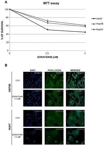 Figure 1 Sorafenib reduced the cell growth and induced morphological alterations in virus-related HCC cell lines. (A) Survival curves of HCC cell lines treated with different concentrations of sorafenib (2.5 and 5 μM) for 48 h. (B) HCC cell lines were treated with sorafenib at 2.5 µM for 48 h, fixed, permeabilized and stained for nuclei with DAPI and for actin with phalloidin. The changes in nuclei and actin filaments were observed by capturing fluorescence images at 20× magnification.