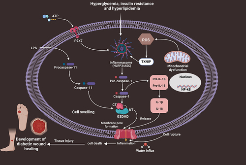 Figure 2 Schematic mechanisms of pyroptosis-dependent cell death in the course of the pathogenesis of DWH. Hyperglycemia, insulin resistance and hyperlipidemia stimulate NLRP3/ASC inflammasome signals, further activating pro-caspase-1 into Caspase-1 form. Then, activated Caspase-1 induces pyroptosis and the generation of inflammatory factors including IL-1β and IL-18, resulting in low-grade inflammation and extensive tissue damage, eventually advancing DWH.