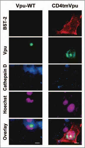Figure 1 Antibody internalization assay (with preincubation at 4°C for 10 min). COS7 cells were co-transfected as described previously,Citation10 with pCA-Vpu-EGFP-RRE (WT or CD4tm mutant), pCA-Rev, and Myc-tagged BST-2 (pCA-BST-2-exMyc-Y6A/Y8A) and cultured for 24 h. To detect Myc-tagged BST-2 internalized at the plasma membrane, transfected cells were cultured in complete medium in the presence of anti-Myc mouse monoclonal antibodies (1:50 dilution) at 4°C for 10 min. After an additional 80 min in complete medium in the presence of lysosomal protease inhibitors (40 μM of leupeptin and pepstatin A), the cells were washed in PBS at 4°C and then fixed with 4% paraformaldehyde. The fixed cells were permeabilized with 0.05% saponin and immunostained with rabbit anti-cathepsin D (1:200). Cy3-conjugated goat anti-mouse and Cy5-conjugated goat anti-rabbit secondary antibodies were used at 5 μg/ml. DN A staining with Hoechst was performed at 0.5 μg/ml. All immunofluorescence images were captured as described previously.Citation10 Bars, 10 μm.