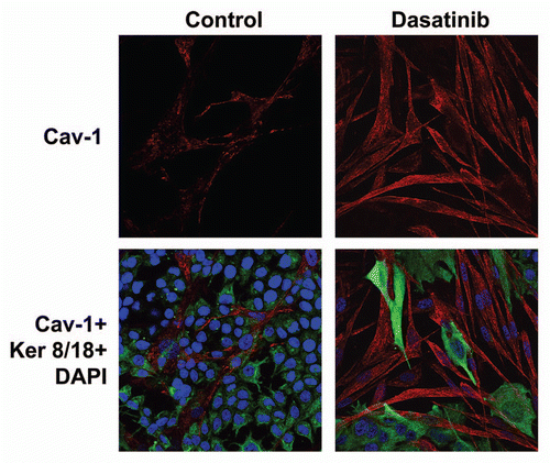 Figure 3 Dasatinib prevents a loss of Cav-1 expression in cancer-associated fibroblasts. MCF7 cells were co-cultured with fibroblasts, in the presence or absence of Dasatinib (2.5 or 5 nM). Then, these co-cultures were immuno-stained with antibody probes directed against Cav-1 (to detect fibroblasts) and Keratin-8/18 (to detect MCF7 epithelial cancer cells). Nuclei were visualized via DAPI staining. Note that Dasatinib treatment rescues the expression of Cav-1, that is normally downregulated in fibroblasts by co-culture with MCF7 cells. Similar results were obtained with both 2.5 and 5 nM Dasatinib. Control represents MCF7-co-cultures treated with vehicle alone.