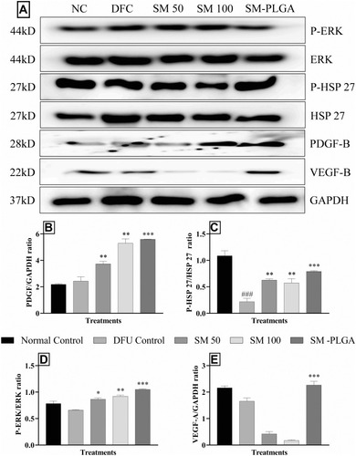 Figure 9 Effect of SM-PLGA nanosuspension on HSP27, ERK, PDGF-B and VEGF expression. (A) Representative images of blots; (B) PDGFB/GAPDH ratio; (C) P-HSP27/HSP27 ratio; (D) P-ERK/ERK ratio; (E) VEGF/GAPDH ratio. Data represented as mean ± SEM, n=3. ###p<0.001 when compared with NC. *p<0.05, **p<0.01 and ***p<0.001 when compared with the DFU. Samples were analysed by one-way ANOVA with Tukey’s post-hoc test.