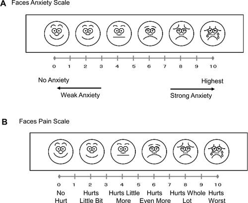 Figure 1 (A) Faces Anxiety Scale. (B) Faces Pain Scale.