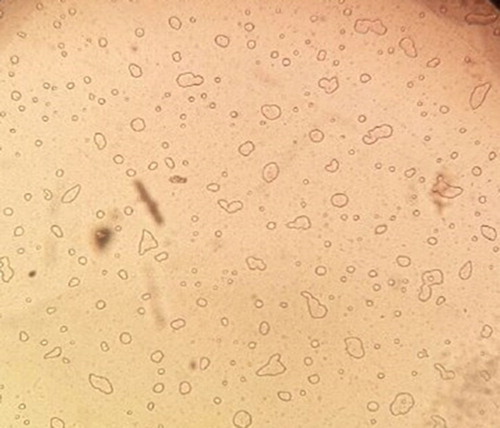 Figure 6. Optical microscope (OM) of UF nanocapsule containing Eucalyptus extract core (F4: optimum formulation).