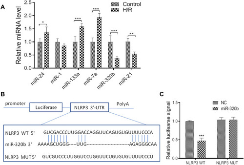 Figure 4 NLRP3 is a target gene of miR-320b. (A). Relative mRNA levels of control and H/R model. (B and C), luciferase reporter assay was performed at 48 h after transfection MCs with luciferase reporter plasmid containing WT or mutant form of NLRP3 3′-UTR along with control mimic or miR-320b mimic. Values are mean ± SE. *P<0.05, **P<0.01, ***P<0.001, n=3 per group.