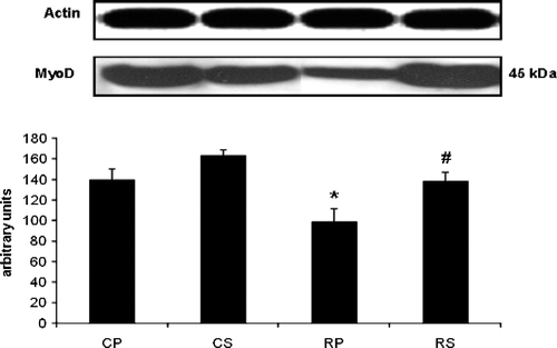 Figure 2  The effect of restraint and Sutherlandia supplementation on MyoD in gastocnemius muscle. Samples were analysed by western blotting with antibodies recognizing MyoD. Results are expressed as means ± SEM for eight independent experiments, *p < 0.05 vs. CP; #p < 0.05 vs. RP, F = 7.298. CP, control placebo; CS, control Sutherlandia; RP, restraint placebo; RS, restraint Sutherlandia.