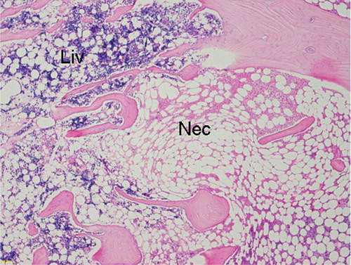 Figure 1. Histopathological features in the CHOL group (×40). Accumulation of bone marrow cell debris was observed, in addition to bone trabeculae showing empty lacunae in the necrotic areas (Nec). 2 weeks after steroid administration in the CHOL group, neither granulation tissue nor appositional bone formation was obvious between the necrotic areas and living bone marrow tissue (Liv).