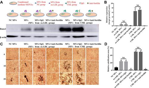 Figure 7 Role of Sortilin in CML-induced SMCs-derived MVs to promote calcification. (A) Western blot was used to detect Runx2 expression in MOVAs under different stimulation. (B) The relative expression of target protein was measured by Image J software. NS, P>0.05. *P<0.05, compared with NC MVs group. #P<0.05, compared with ox-LDL MVs group. (C) Calcification of MOVAs was showed by vonkossa staining. (D) The ratio of calcification area to total area in a 20x field of view was measured by Image J software. NS, P>0.05. *P<0.05, compared with NC group. #P<0.05, compared with ox-LDL MVs group.