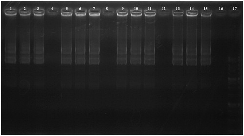 Figure 3. DNase I protection assay. Lanes 1–4: PEI-SUC 10% series treated with DNase I at C/P ratios of 0.25, 2, 4, and 8, respectively; Lanes 5–8: PEI-SUC 20% series treated with DNase I at C/P ratios of 0.25, 2, 4, and 8, respectively; Lanes 9–12: PEI-SUC 30% series treated with DNase I at C/P ratios of 0.25, 2, 4, and 8, respectively; Lanes 13–16: PEI-SUC 10% series treated with DNase I at C/P ratios of 0.25, 2, 4, and 8, respectively; Lane 17: DNA size marker.