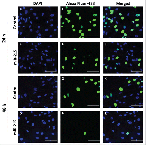 Figure 3. Cell proliferation was analyzed using the Click-it EdU Alexa Fluor 488 (Life Technologies, Carlsbad, CA, USA) assay according to the manufacturer′s protocol. Pterygium fibroblast cells reverse-transfected with miR-215 mimic or non-specific oligonucleotide control and 10 uM of 5-ethynyl-2′-deoxyuridine (EdU) added and incubated for 10 h. (I), Cells transfected with miR-215 for 24 h, (J) cells transfected with control for 24 h, (K), cells transfected with miR-215 for 48 h, (L), cells transfected with control for 48 h; (E), (F), (G), (H), DAPI fluorescence only, for the same cells in (I)-(L), respectively; (A), (B), (C), (D), Alexa-Fluor 488 fluorescence only. Images shown are representative of 3 experiments. Scale bar represents 100 uM.