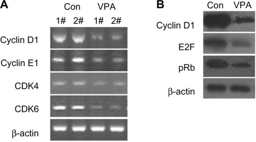 Figure 4 Valproic acid downregulates transcription of cyclin D1, cyclin E1, CDK4, and CDK6, and upregulates transcription and protein expression of p21. Comparison between control group and valproic acid after two weeks of treatment. (A) Expression of cyclin D1, cyclin E1, CDK4, and CDK6 detected by reverse transcriptase polymerase chain reaction. (B) Expression of cyclin D1, E2F, and retinoblastoma protein by Western blotting.