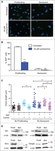 Figure 3. Hedgehog inhibition blocks proliferation and increases cilium length; (A) Immunofluorescence microscopy of BJ cells stained with antibodies to Ki67 (green). DNA was visualised with DAPI (blue). Scale bar, 10 μm; (B) Quantitation of the proliferative index of BJ cells after the indicated treatment, as determined by microscopy analysis of Ki67 signal. Histograms show means ± s.d. of 3 separate experiments in which at least 100 cells were quantitated; (C) Quantitation of cilium length in the indicated cells. At least 30 ciliated cells were scored for each condition, even when there were very few such cells. ***, P < 0.001 in comparison to untreated or indicated controls by unpaired t-test. ‘ns’, not significant; (D) Immunoblot analysis of the indicated protein expression in BJ cells. Size markers are indicated in kDa.