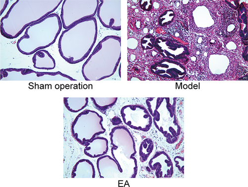 Figure 3 Comparison of prostatic histomorphology in rats. Scale bar=250 μm, HE×100 times. There were inflammatory cell infiltration and atrophic glandular cavity in the model group.