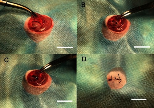 Figure 8 In vivo experimental operation.Notes: (A) Incision and exposure of surgical area, (B) implantation model formation, (C) implant embedment, and (D) suture of surgical area; bar =1 cm.