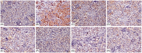 Figure 10. Deposition of NF-κB p65 on renal tubules using immunohistochemistry detected with DAB kit. (A) Blank control, (B) 72 h TCE+, (C) 72 h B1RA+, (D) 72 h B2RA+, (E) vehicle control, (F) 72 h TCE−, (G) 72 h B1RA−, and (H) 72 h B2RA− group. Magnification =200×. Representative photos are shown.