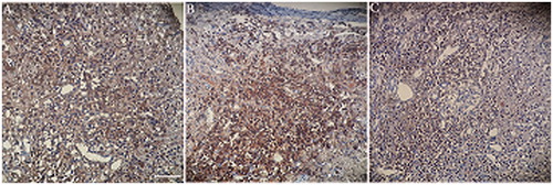 Figure 10. Photomicrographs of cross-sections CD31-stained sections (Dark) 12-week after nerve grafting. Autograft (A), conduit (B), conduit + NGF (C). Scale bar, 20 µm.