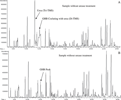 Fig. 1. Total ion chromatograms from a urine sample without (A) or with (B) urea treatment. Note the disappearance of urea with urease treatment. One mL of sample, with GHB concentration of 100 mg/L, was used for analysis.