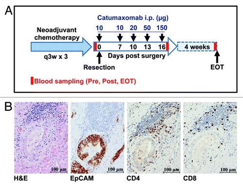 Figure 1. Tumors of gastric cancer patients treated with catumaxomab show strong expression of EpCAM and pre-therapeutic infiltration by CD4+ and CD8+ T cells. (A) Within the IP-CAT-GC-03 trial, a total of 6 patients were treated at our center with intraperitoneal (i.p.) catumaxomab as shown. Blood samples (Pre, Post, EOT) for immunomonitoring were collected at three time-points as indicated by red bars. (B) Resected tumors from all 6 gastric cancer patients were analyzed by immunohistochemistry (magnification × 400). Consecutive cuts are shown from the block of one representative subject (patient GC-3). In addition to a routine H&E stain, tumor samples were analyzed for the expression of EpCAM protein as well as for the presence of CD4+ and CD8+ T cells.