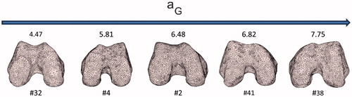 Figure 6. Five distal femur surfaces along with their corresponding aG parameters. A monotonic increase of the parameter corresponds to a decrease of the roundness of the trochlea.