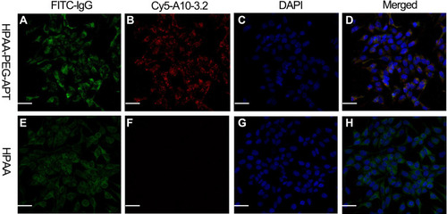 Figure 2 The specificity of the aptamer in LNCaP cells. (A and E) Identification of PSMA expression in LNCaP cells via indirect immunofluorescence using anti-PSMA monoclonal antibody and FITC-labeled lgG secondary. (B and F) Identification of Cy5-labeled A 10–3.2 aptamer binding to LNCaP cells using direct immunochemistry. (C and G) cell nuclei with DAPI-stained. (D and H) Merged fluorescence images. Scale bars:50μm.