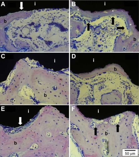 Figure 9 Higher magnification of the histological cross sections after 2, 4 and 6 weeks of the control group (A: 2 weeks, C: 4 weeks, E: 6 weeks) and the coated group (B: 2 weeks, D: 4 weeks, F: 6 weeks). Osteoblastic seams (B, black arrows) formed osteoid (asterisk) onto the coating. The decreased BIC after 6 weeks (Figure 7) is caused by osteoclastic resorption (F, black arrows), ie bone remodeling.Abbreviations: BIC, bone-to-implant contact; i, implant; b, bone.