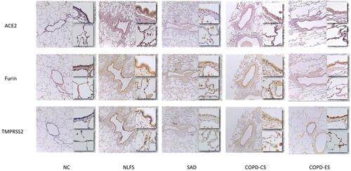 Figure 1 Micrographs of ACE2, Furin and TMPRSS2 protein expression in the small airways of smokers and COPD patients. The top inset images depict small airway epithelium taken at x40 magnification. The bottom inset images depict the parenchymal alveoli at x20 magnification.