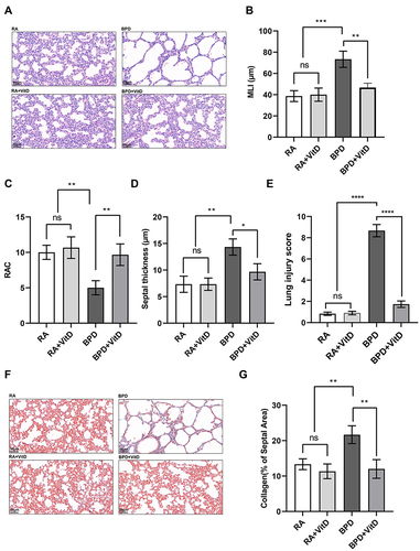 Figure 1 Vitamin D (VitD) decreases alveolar simplification and lung fibrosis induced by hyperoxia in newborn mice. (A–E) Hematoxylin and eosin images showing the characteristic simplification of lung alveolarization in the bronchopulmonary dysplasia group. VitD therapy improved lung alveolarization, as quantified by mean linear intercept, radial alveolar count, lung injury score, and septal thickness changes. (F–G) Representative Masson’s trichrome staining of lung tissues. VitD treatment ameliorated lung fibrosis induced by hyperoxia, as quantified by changes in the collagen rate of the septal area. The results shown were observed in at least three independent experiments. N = 10 mice per group; scale bar = 50 µm; magnification at 20X. *p < 0.05; **p < 0.01; ****p < 0.0001.