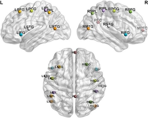 Figure 1 The distribution diagram of regions of interesting which stand for eight resting-state networks.